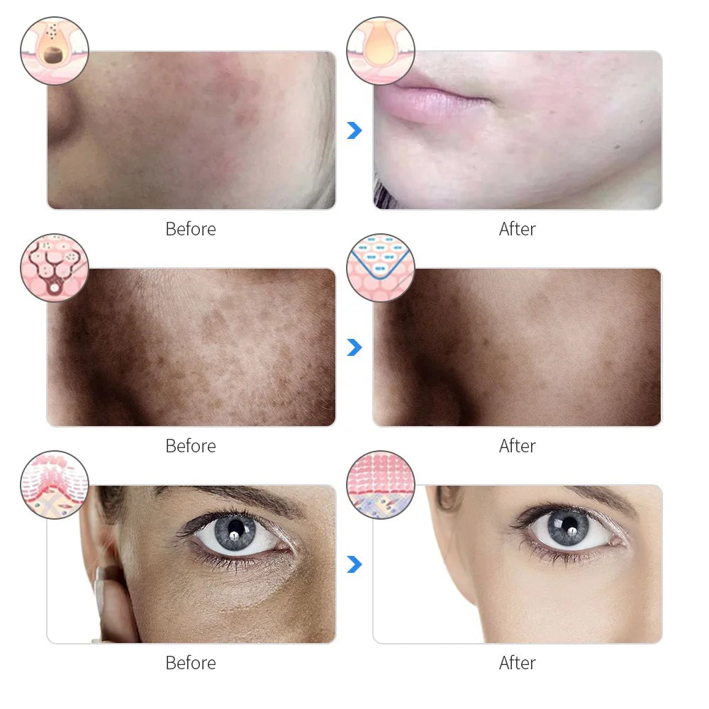 Máscara facial recarregável de LED com 7 cores
